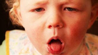 Dane County whooping cough cases highest in more than a decade